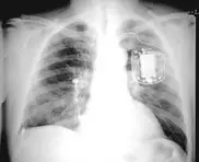 Казахстанские врачи проникли в сердце пациента через Интернет