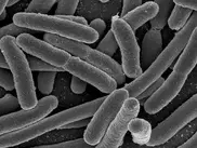 Ученые: "Немецкая" кишечная палочка угрожает только ослабленным людям