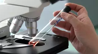 В Кыргызстане c подозрением на сибирскую язву госпитализированы 2 человека 