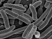 В США вспышка листериоза унесла жизни 13 человек