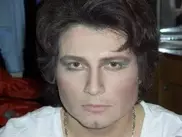 Басков сделал неудачную пластическую операцию