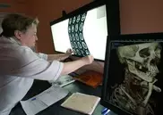 Ученые обнаружили гены формирования лица человека