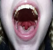 В Астане нуждающимся бесплатно вернут голос