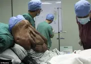 Китайские хирурги прооперировали "человека-слона"