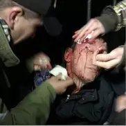 Украина: Бойцы "Беркута" разбили голову экс-министру Луценко