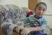 Больному ихтиозом мальчику из Уральска собирают деньги на лечение в Москве