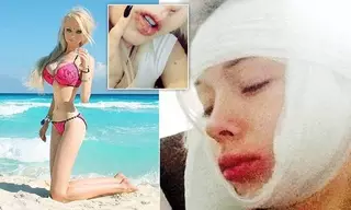 Украинскую Барби избили на Хэллоуин