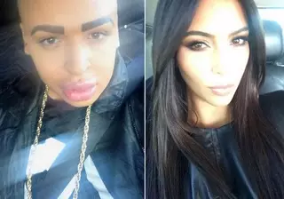 Фанат Ким Кардашьян потратил 100 тысяч фунтов на операции ради сходства с ней