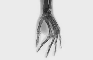 Вредно ли хрустеть костяшками?