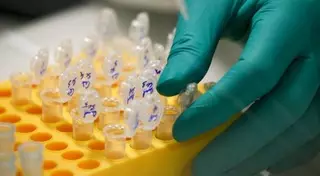 Названы возможные причины реакции на вакцину от кори