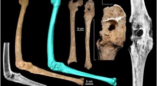 Кости, найденные в комплексе захоронений в Вергине. © livescience.com