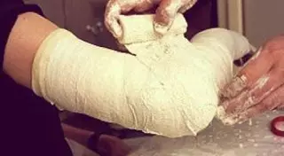 Житель Кокшетау сломал руку, убегая от полицейских