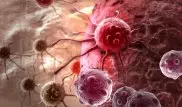 Ученые выявили механизм роста раковых клеток в человеческом организме