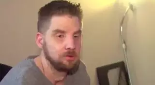 В США мужчине с "пересаженным" лицом вернули былую внешность