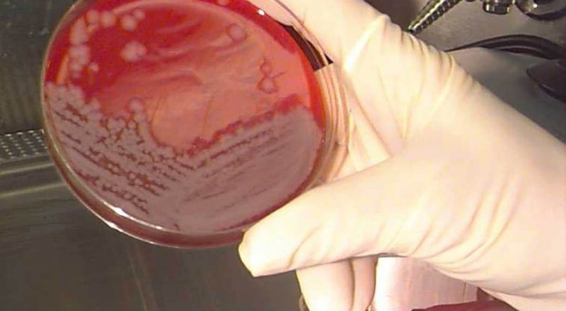 Фото с сайта pbs.org