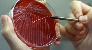 Врачи Караганды пока не подтверждают вспышку сибирской язвы в Актогайском районе