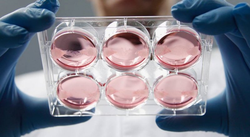 Фото с drdhawan.in