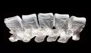 Ученые научились "ремонтировать" переломы костей при помощи 3D-печати