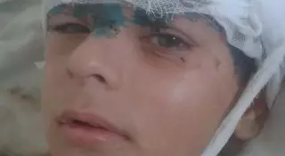 120 швов наложили на голову школьника после ДТП в Карагандинской области