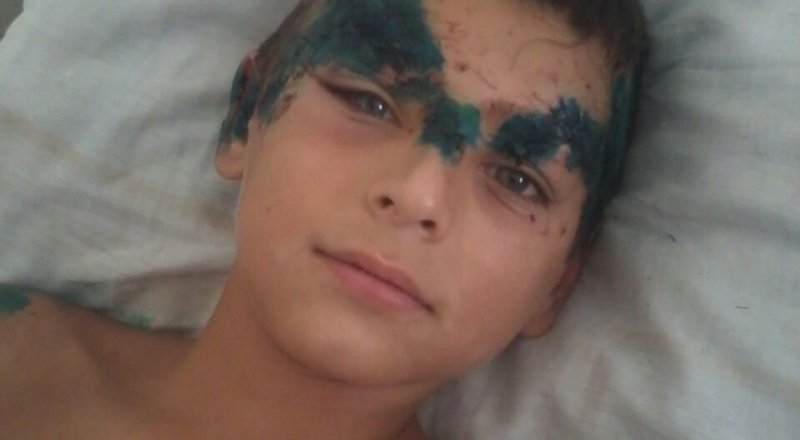 Фото мальчика после ДТП 