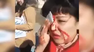Женщина разбила лицо при попытке сесть в автобус в Караганде