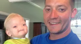 Родившийся без носа мальчик умер спустя два года в США