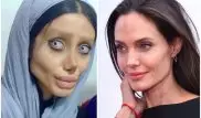 Иранка перенесла 50 операций ради сходства с Анджелиной Джоли
