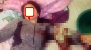 "Я истекала кровью, а он ехидно смеялся". Актюбинка получила ножевые ранения в ссоре с экс-супругом