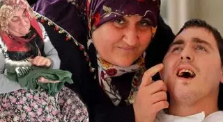 В Анталье умер Умут, о судьбе которого рассказывали в "Пусть говорят"