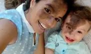 Гордая мать скопировала огромную родинку сына на собственное лицо
