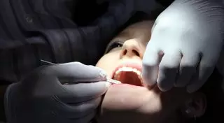 Найден способ восстанавливать зубную эмаль