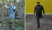 "Оторвал себе ногу, чтобы остаться в живых": житель Темиртау учится жить по-новому