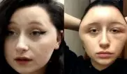 Лицо француженки деформировалось из-за краски для волос