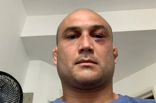 Би-Джей Пенн. instagram.com/bjpenn