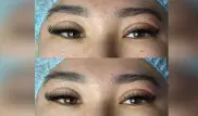 Қазақ қыздары неге жиі блефаропластика жасататын болған?