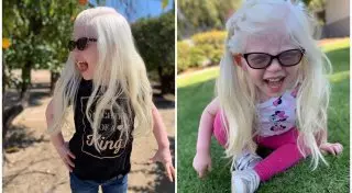 Сверхъестественная красота. Девочка-альбинос живет в тени, но в любви родителей