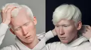 Парень-альбинос из Уральска поразил казахстанцев редкой красотой