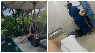 Казахстанка показала последствия "укуса" насекомого на Бали