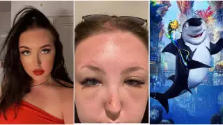 Отпуск туристки превратился в кошмар из-за отравления солнцем