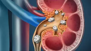 Фото: hopkinsmedicine.org