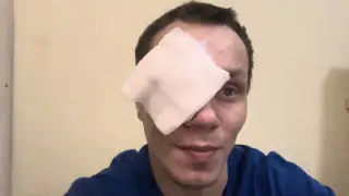 Боец ММА лишился глаза после конфликта с девушкой