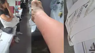 Вагон кошмара: казахстанка пожаловалась на укусы клопов в поезде до Костаная