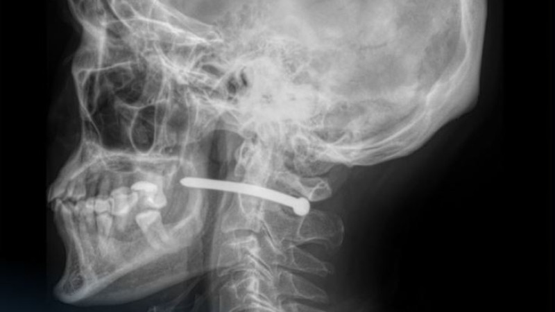 Фото: пресс-служба многопрофильной городской больницы