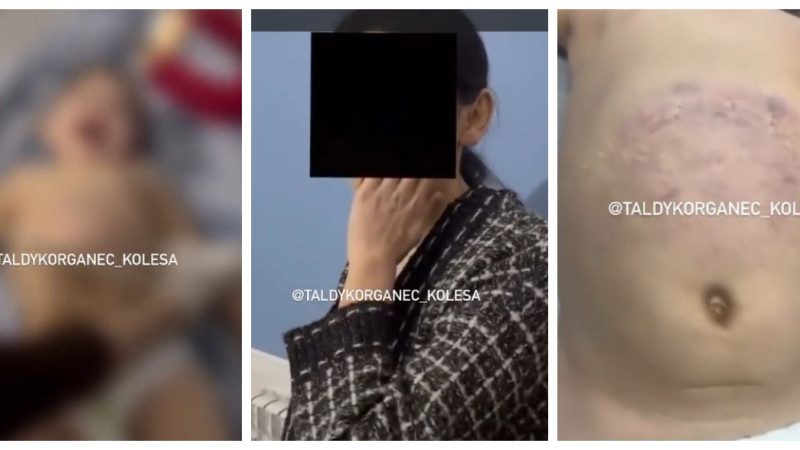 instagram/taldykorganec_kolesa