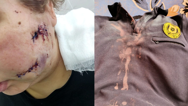 Фото предоставлено пострадавшей