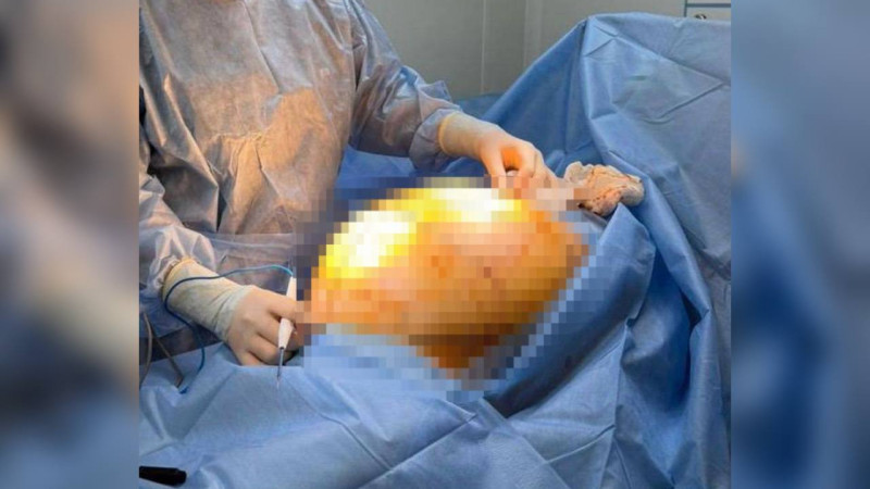 Фото: пресс-служба Министерства здравоохранения