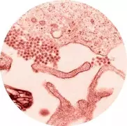 US West Nile deaths, infections rise at slower pace 