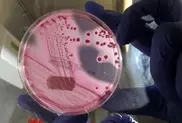 Gene sleuths track spread of hospital superbug 