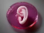Lifelike ears created with 3D printing 