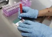 DNA flaw boosts cancer risk from diabetes: study 